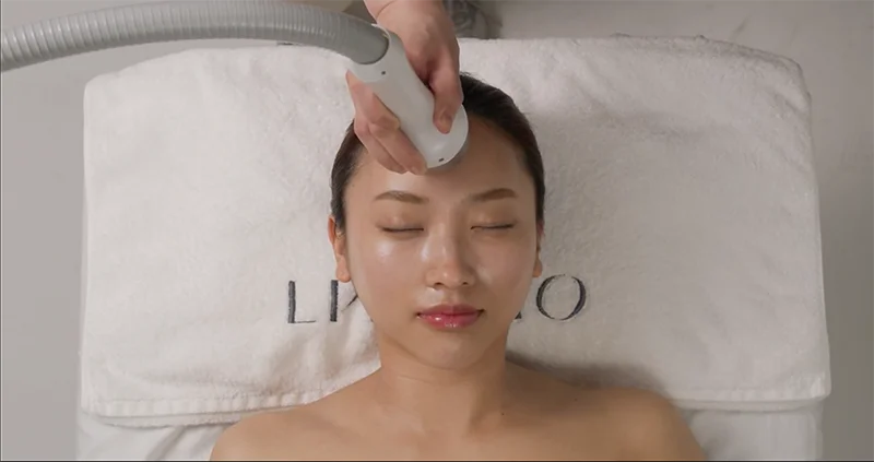 眉から額にかけての施術の様子